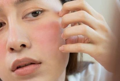 CHỌN CHĂN GA GỐI CHO LÀN DA CỦA CHÍNH BẠN
